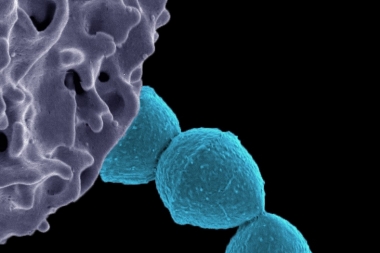 La bacteria Streptococcus Pyogenes está causando alarma en todo el país