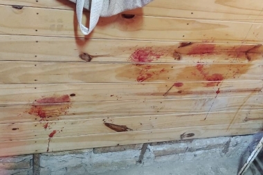 Punta Lara: Una mujer fue internada luego de que su pareja intentara matarla a golpes y machetazos